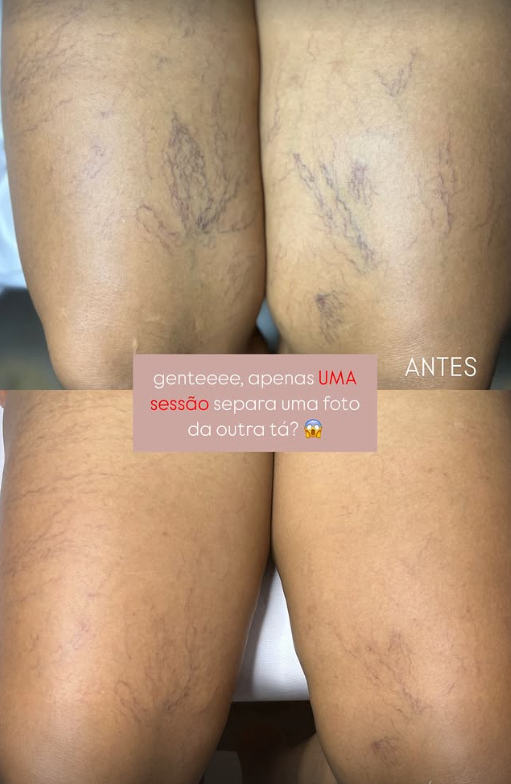 Depoimento de cliente 4